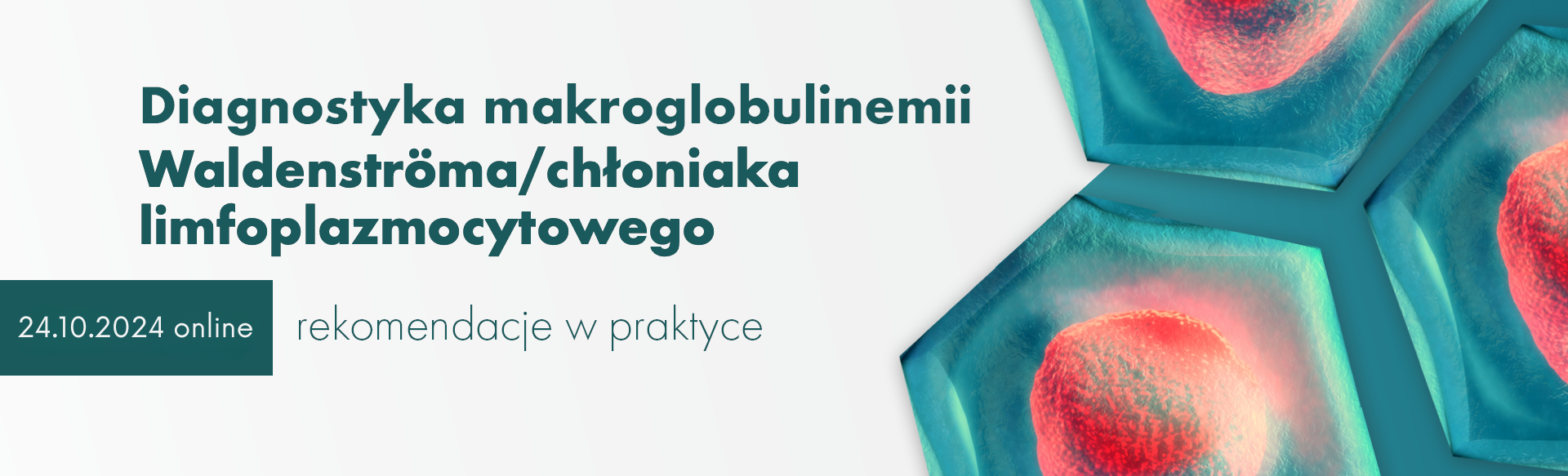 Diagnostyka makroglobulinemii Waldenströma i chłoniaka limfoplazmocytowego – rekomendacje w praktyce