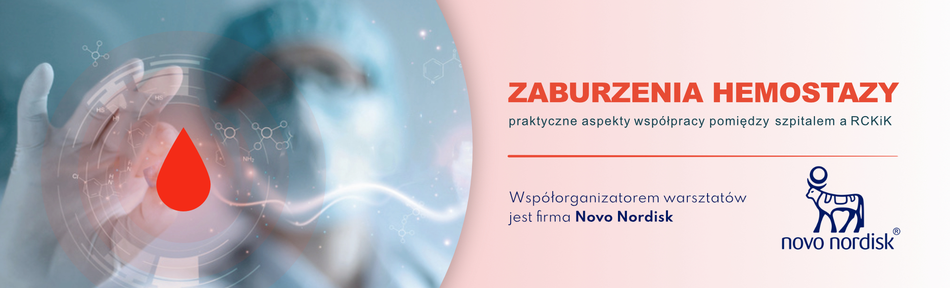 Zaburzenia hemostazy, praktyczne aspekty współpracy pomiędzy szpitalem a RCKiK - Rzeszów